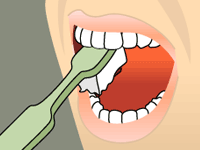 brushing diagram